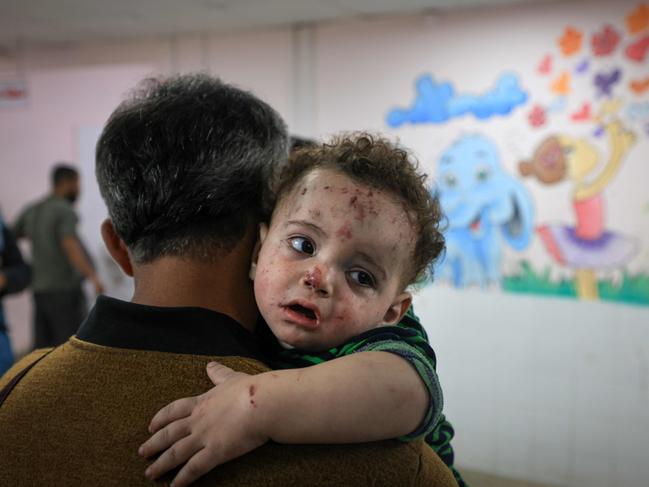 A man holds one of the injured children of Palestinian cameraman Mohammed Alaloul following an Israeli strike on the Al-Maghazi refugee camp in Deir Balah. Picture: AFP