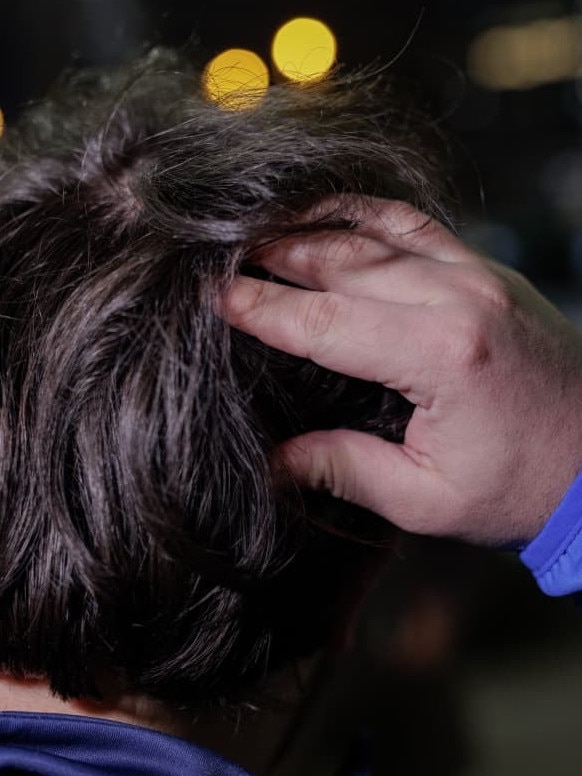 Ofek Ziv, a Maccabi Tel Aviv supporter, shows where he says he was struck on the head. Picture: Jagoda Lasota/WSJ