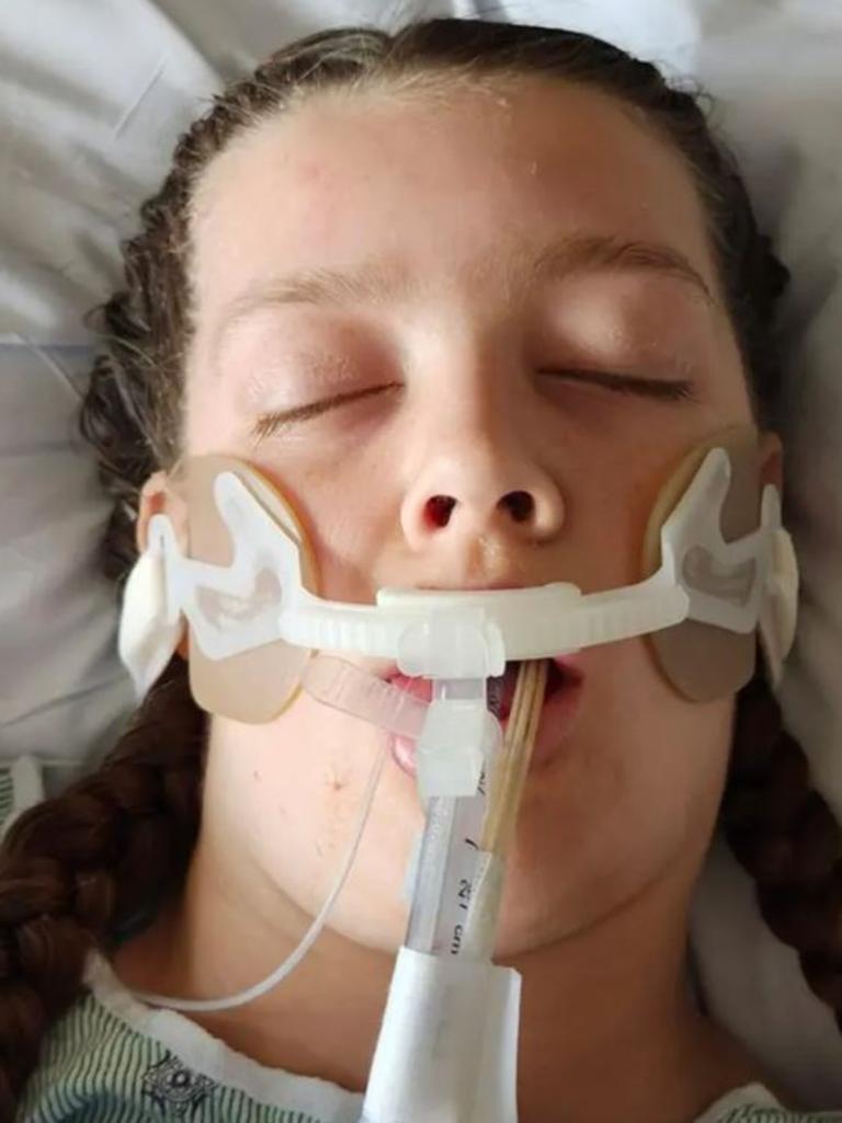 Severe brain swelling caused her body to shut down. Picture: Facebook