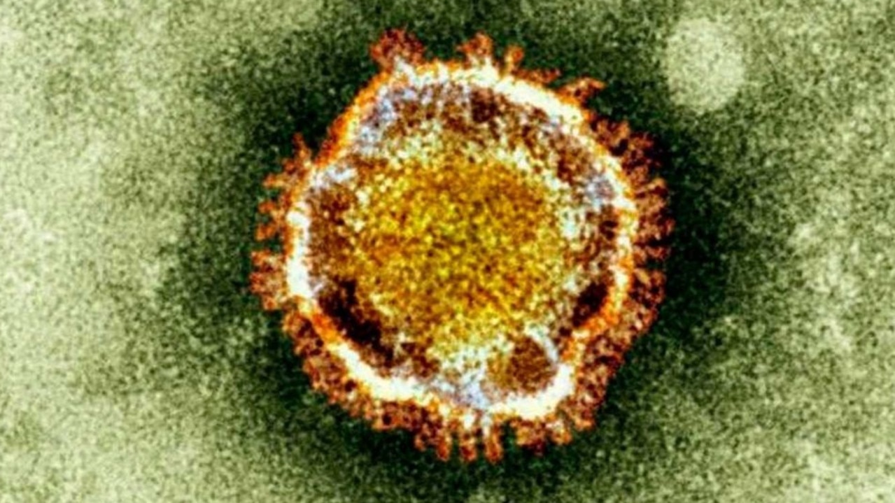 The coronavirus as seen under a microscope. Picture: British Health Protection Agency