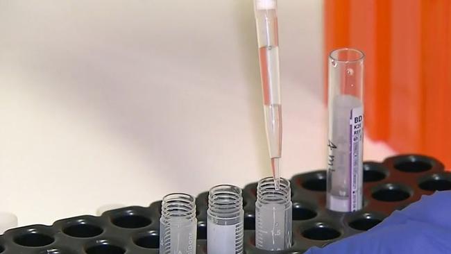 First trials of Australia’s coronavirus vaccine begin on Monday. Picture: Channel 9