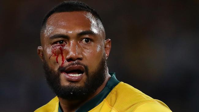 Sekope Kepu of the Wallabies heads to the blood bin.