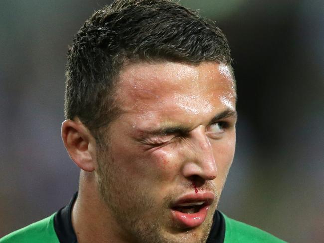 South Sydney's Sam Burgess injured face during the 2014 NRL Grand Final between the South Sydney Rabbitohs and the Canterbury Bankstown Bulldogs at ANZ Stadium .Picture Gregg Porteous