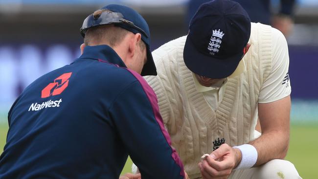 Jimmy Anderson gets some attention on his ailing calf muscle.