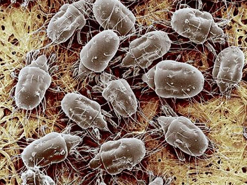 Dust mites can trigger allergies and asthma, and commonly breed in mattresses and soft furnishings Picture: Supplied