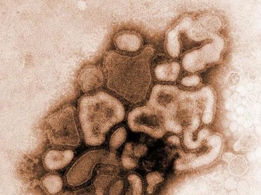 Microscope view of the H1N1 influenza (flu) strain virus.