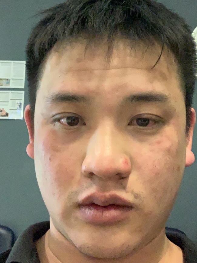 Mr Poon was kicked repeatedly in the head. Picture: Supplied