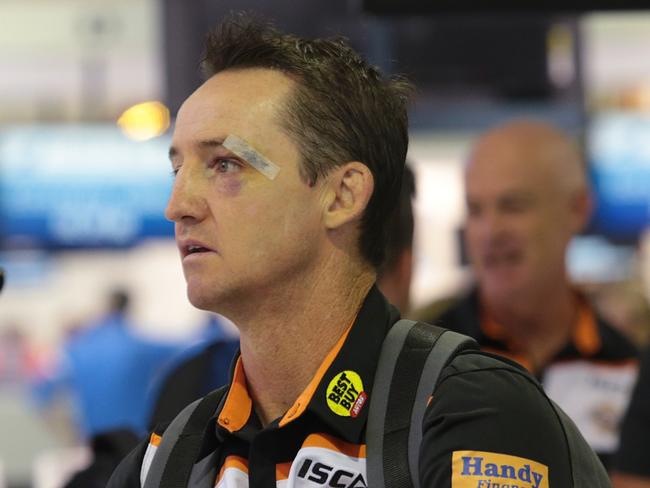 Jason Taylor sporting a decent shiner at Sydney airport. Picture: John Fotiadis