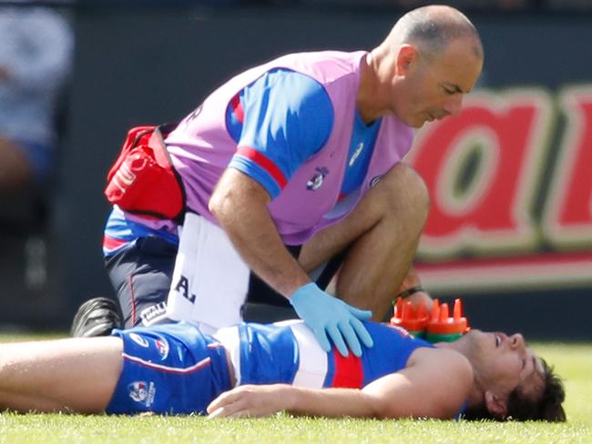 BALLARAT, AUSTRALIA - MARCH 03:  Liam Picken of the Bulldogs lies on the field injured during the AFL JLT Community Series match between the Western Bulldogs and the Hawthorn Hawks at Mars Stadium on March 3, 2018 in Ballarat, Australia.  (Photo by Scott Barbour/Getty Images)