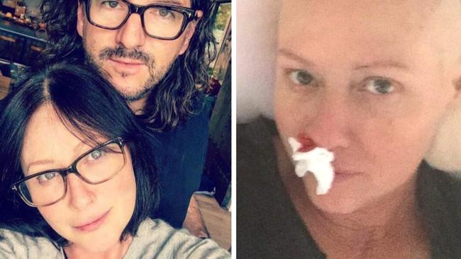 Shannen Doherty is battling cancer.