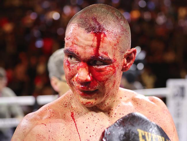 LAS VEGAS, NEVADA - MARCH 30: WBO junior middleweight champion Tim Tszyu (L) walks to his corner after a 12-round fight against Sebastian Fundora at T-Mobile Arena on March 30, 2024 in Las Vegas, Nevada. Fundora won Tszyu's title and a vacant WBC title by split decision. (Photo by Steve Marcus/Getty Images)