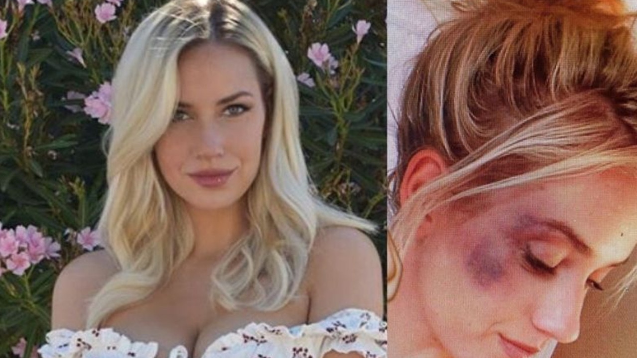 Paige Spiranac posts “nasty” proof of run-in with boozy college roommate.