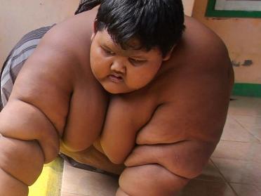Picture: Caters ONLINE USE ONLY PIC FROM SIJORI IMAGES/CATERS NEWS - (PICTURED: Arya Permana 10-years-old is a giant boy from West Java Province, Indonesia.)- A ten-year-old is being put on a crash diet for fear he may die - after scoffing his way to becoming the worlds fattest child. Arya Permana weighs an eye-watering 192kg and is categorised as morbidly obese. His rapid weight-gain has forced him to quit school because he can no longer physically walk. Arya scoffs five meals a day consisting of rice, fish, beef, vegetable soup and Tempeh - a traditional soy patty - which alone is normally enough to feed two adults. And because of his astonsihing weight, his parent shave been unable to find clothes that fit him, leading to him wearing just a sarong. SEE CATERS COPY.