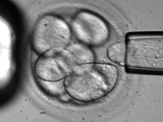 In this file photo originally made available by Advanced Cell Technology in 2006, a single cell is removed from a human embryo to be used in generating embryonic stem cells for scientific research. Shares of companies developing stem cell therapies surged Wednesday, Dec. 2, 2009 on news that the federal government has cleared 13 new stem cell lines for testing, bringing to a close nearly a decade of restrictions. (AP Photo/Advanced Cell Technology)