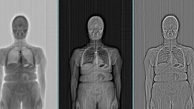 An X-ray scan revealing a bra had been stuffed with several contraband items during the visit. Picture: NSW Police