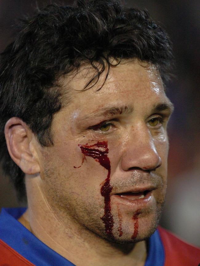 O'Davis after an on-field knock in 2004.