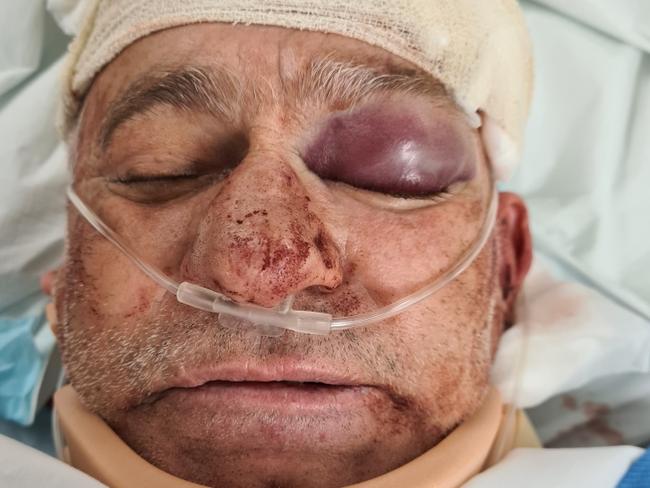 Western Sydney father Shane Wardle was rushed into emergency surgery last night after two men stormed his Parramatta home armed with a hammer and meat clever.