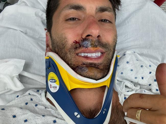 Nev Schulman involved in horror accident