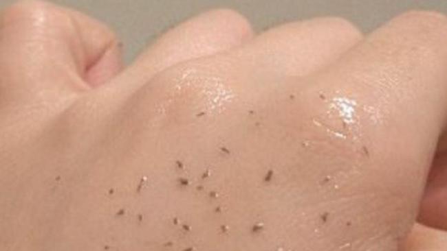 The blackheads are removed used an oil-based cleanser. Picture: Reddit