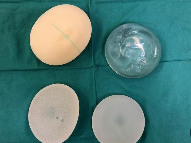 Allergan says it will cover $5000 of the out of pocket medical costs incurred to have the dodgy breast implants removed. Picture: Supplied