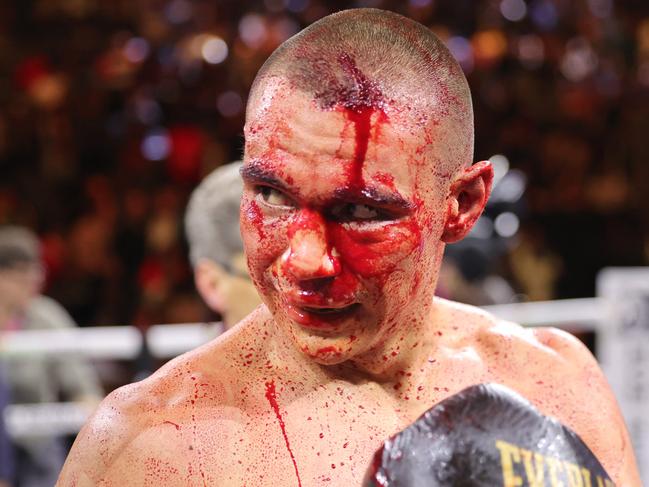 LAS VEGAS, NEVADA - MARCH 30:  WBO junior middleweight champion Tim Tszyu (L) walks to his corner after a 12-round fight against Sebastian Fundora at T-Mobile Arena on March 30, 2024 in Las Vegas, Nevada. Fundora won Tszyu's title and a vacant WBC title by split decision. (Photo by Steve Marcus/Getty Images)