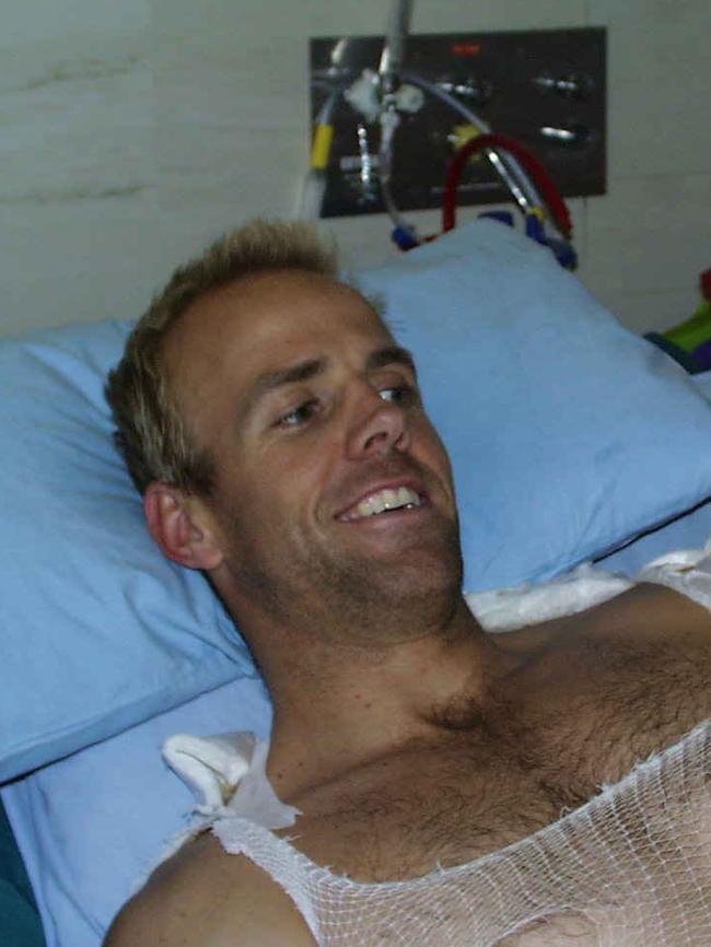 He received third degree burns to 30 per cent of his body.