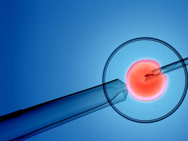 3D rendering of the icsi(intracytoplasmic sperm injection) process - in which a single sperm is injected directly into an egg