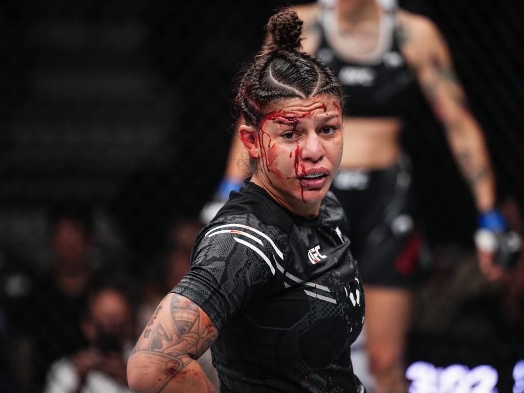 Mayra Bueno Silva was ruled out due to her graphic cut. Picture: Jeff Bottari/Zuffa LLC via Getty Images