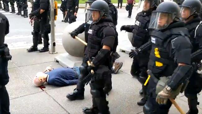 A 75-year-old protester bleeds from his ear after being shoved by Buffalo, New York, police, on June 4.