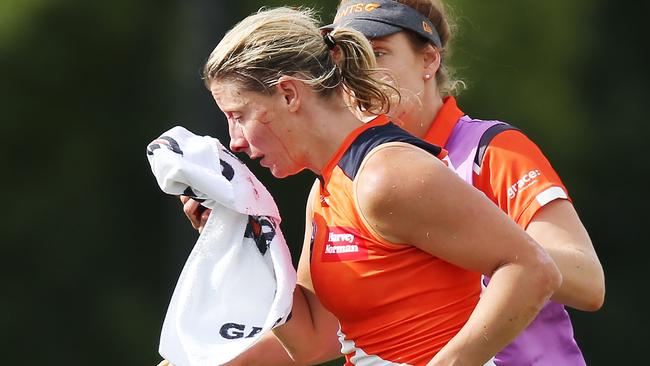 Cora Staunton was left blooded after copping an elbow to the face from Magpie Sophie Casey. Picture: Getty
