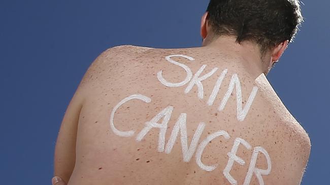 Men are being urged to get checked if they noticed any changes, both on their skin and their body. Picture: David Caird