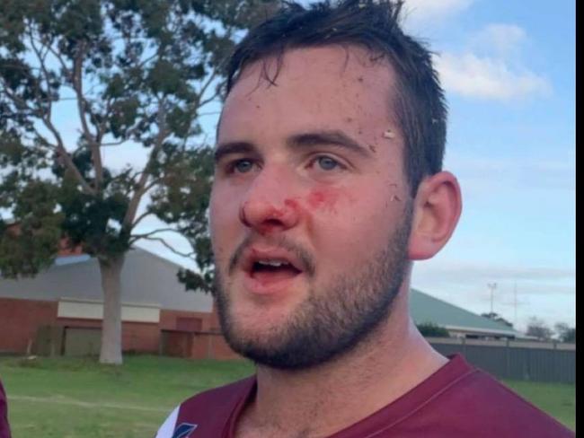 Colonel Light Gardens player Bryce Smith after smothering the ball with his face to win the game on Saturday. Picture: Supplied