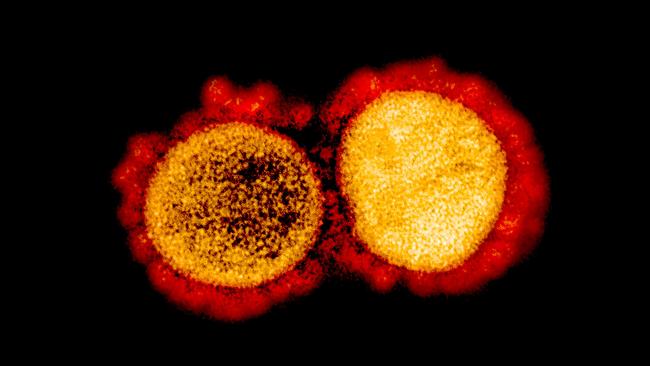 A transmission electron micrograph of SARS-CoV-2 virus particles, isolated from a patient. Picture: AFP