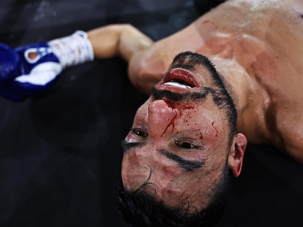 Dib moments after the stoppage. Picture: No Limit Boxing