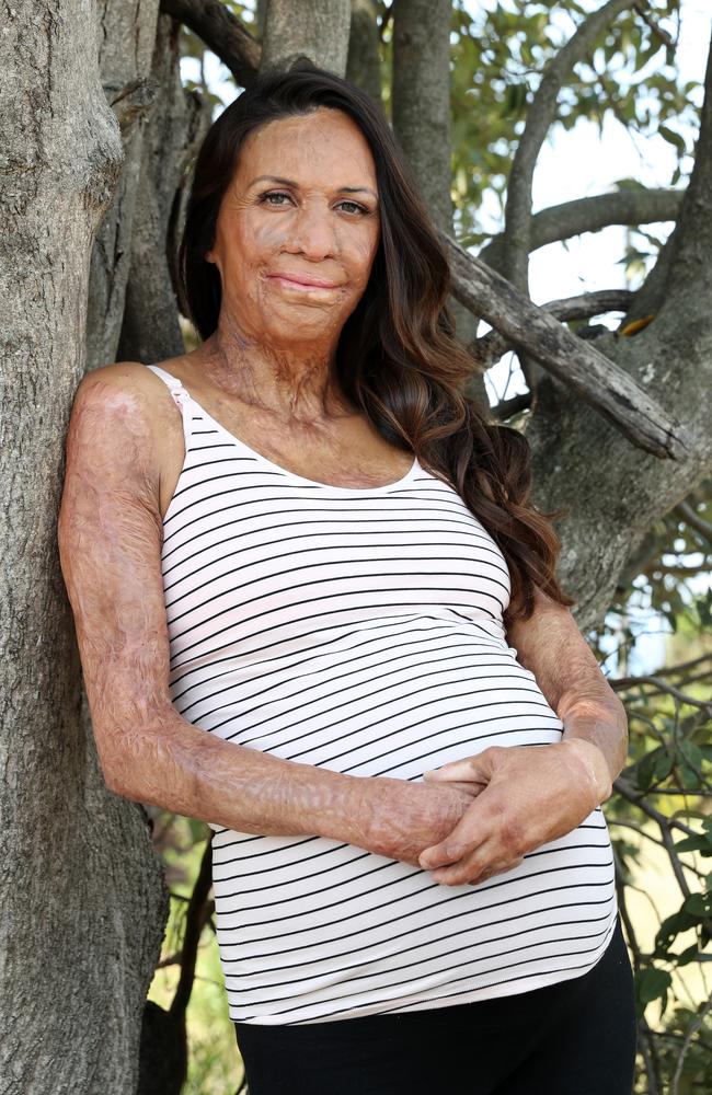 Turia Pitt says she “lucked out” with an easy second pregnancy. Picture: Jonathan Ng