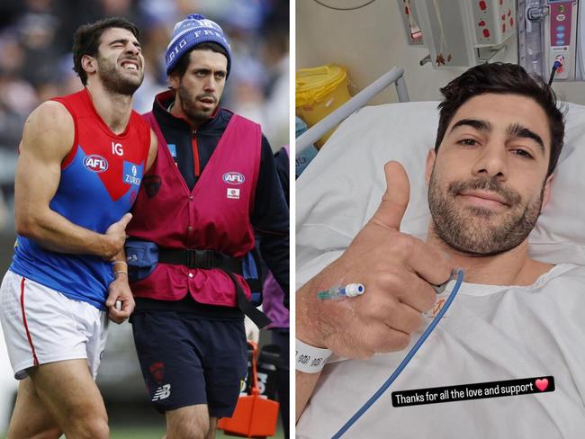 Christian Petracca after the injury and in hospital. Photos: News Corp/Instagram