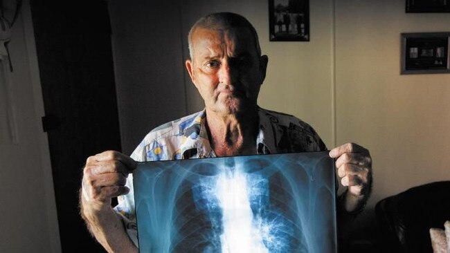 Percy Verrall was diagnosed with black lung disease in 2015. He was the first Australian diagnosed with the disease in 30 years.