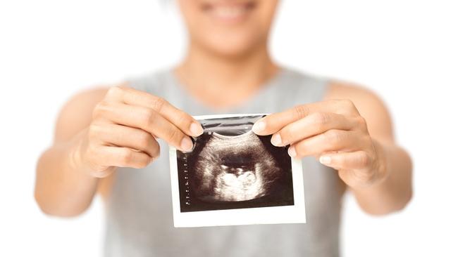 RendezView. Pregnant woman is showing her Ultrasound. (Pic: iStock)