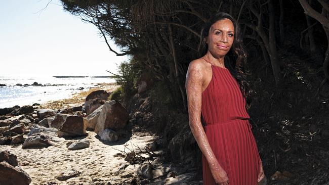 “If I look in the mirror I might be critical about some aspect of my appearance but I feel like even women who are conventionally attractive may do that.” (Picture: Supplied)