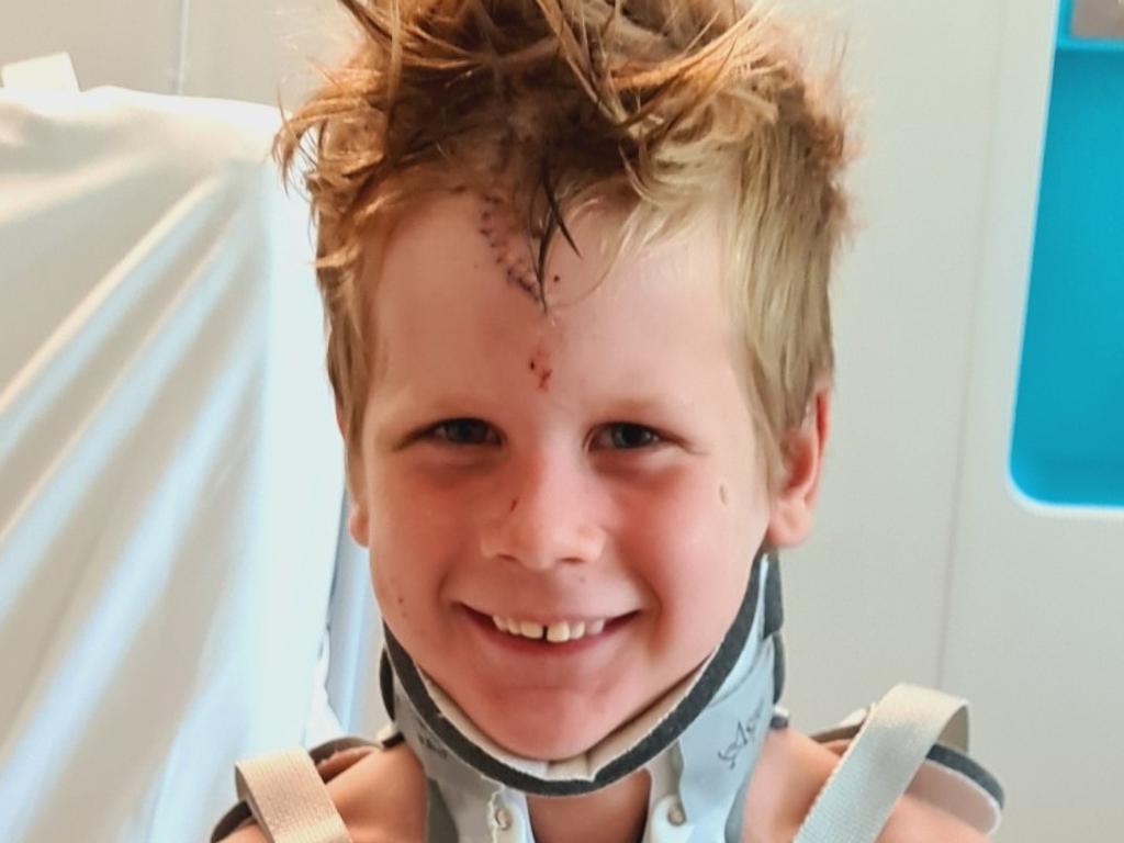 Daniel Ford, 7, suffered spinal fractures and a 30cm gash to his head after the fall but is recovering well.