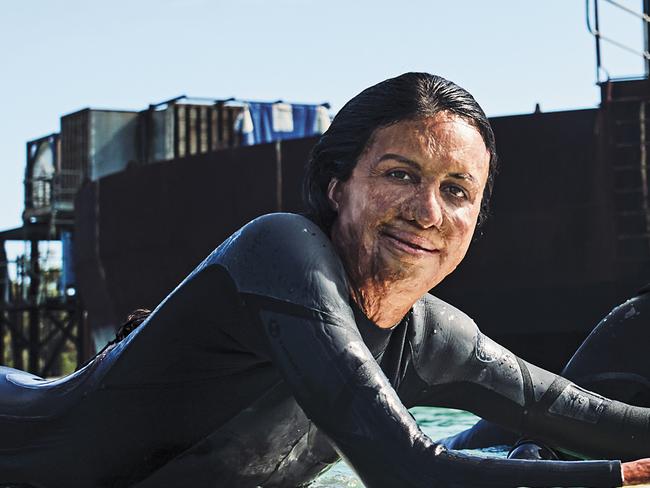 Sam Bloom and Turia Pitt by Andrew Shield
