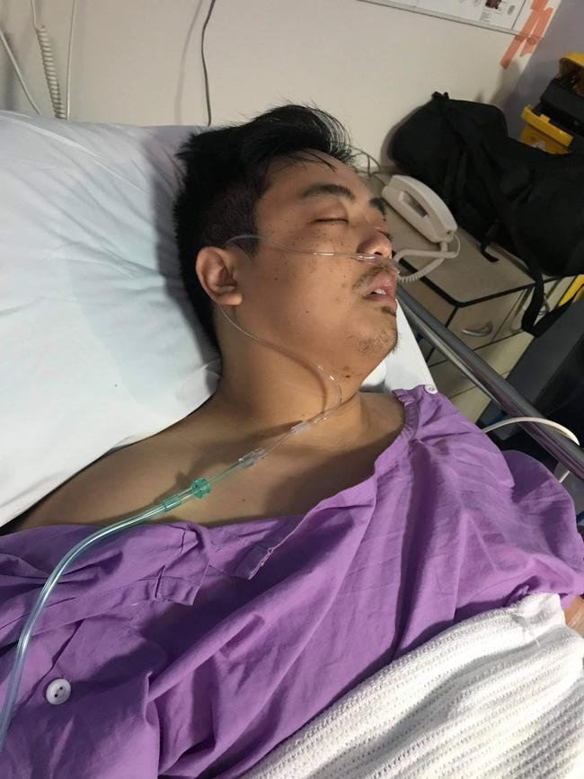 Motorcyclist Henry Sun was seriously injured when he was struck by a car in Enoggera. Picture: Supplied