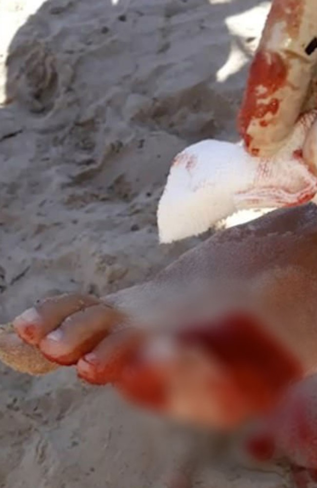 Local TV reports showed some of the gruesome injuries. Picture: El Litoral