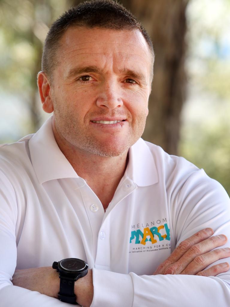 Jay Allen has been raising awareness about melanoma for years. Picture: Jonathan Ng