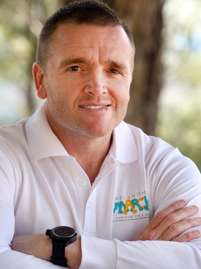 Jay Allen has been raising awareness about melanoma for years. Picture: Jonathan Ng