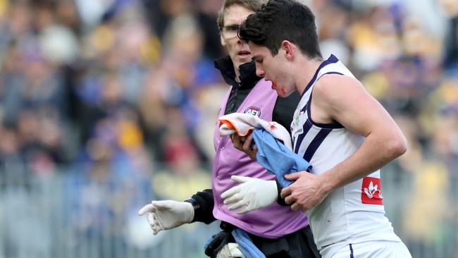 Andrew Brayshaw was sent to hospital to be treated for a suspected broken jaw.