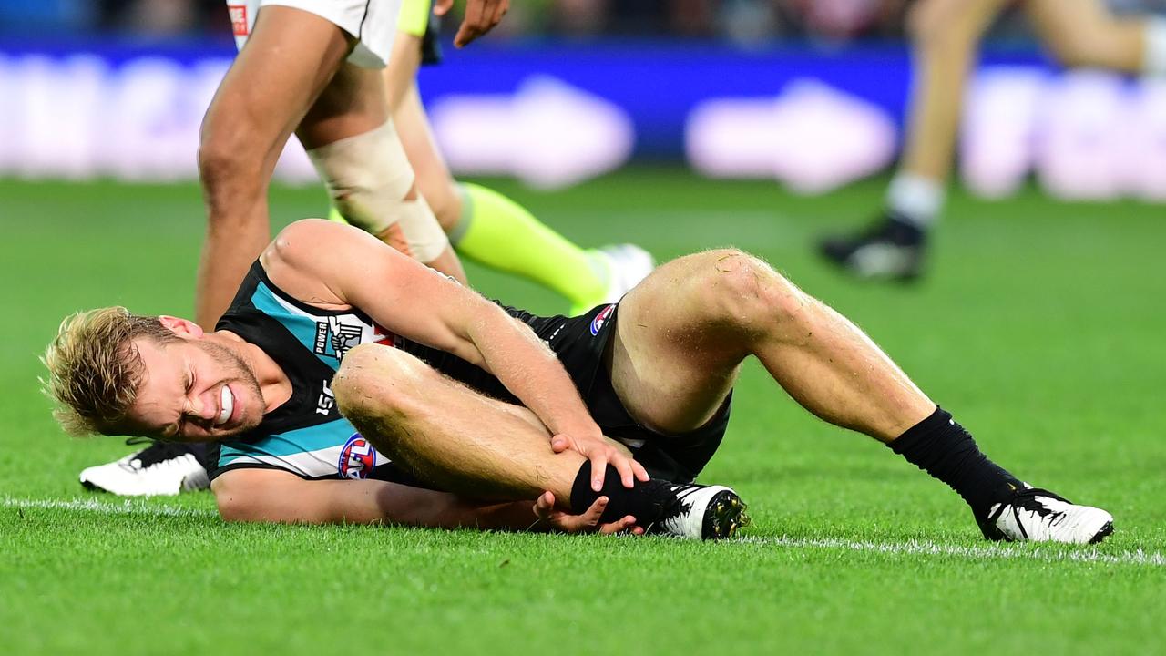 Jack Watts appears to have suffered a serious injury to his ankle. Picture: Getty Images