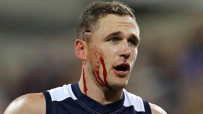 Joel Selwood was left with a huge gash after copping a heavy knock early in last night’s game. Picture: Michael Klein