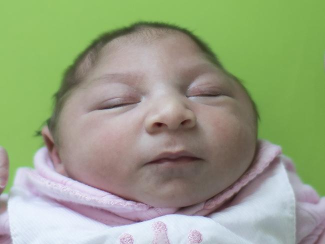 Sophia, who is two weeks old and was born with microcephaly, sleeps before her physical therapy session at the Pedro I hospital in Campina Grande, Paraiba state, Brazil, Friday, Feb. 12, 2016. The Zika virus, spread by the Aedes aegypti mosquito, is suspected to be linked with occurrences of microcephaly in new born babies, but no link has been proven yet. (AP Photo/Felipe Dana)