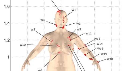 Images from a report for police by biomechanics expert Zac Couper. The reproduction of all wounds to Shandee Blackburn apart from those to the fingers and thumb of the left hand are shown projected onto the body surface model.